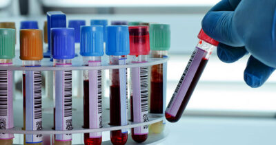 Laboratory Services